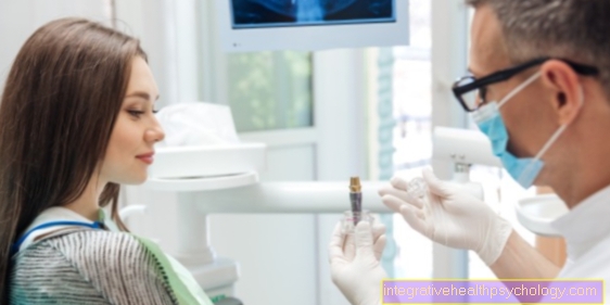 Risks of a dental implant