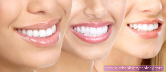 How do you get white teeth?