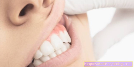 How can you rebuild gums?
