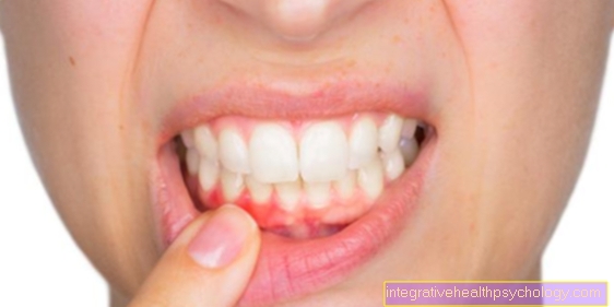 What is the best way to stop bleeding gums?
