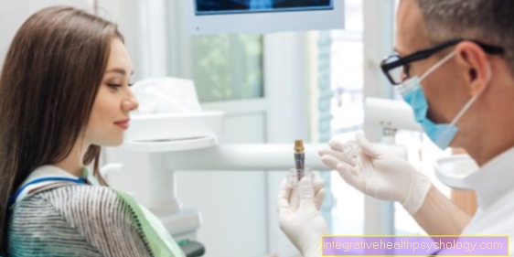 Laser root canal treatment