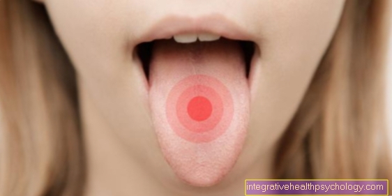 Tongue inflammation